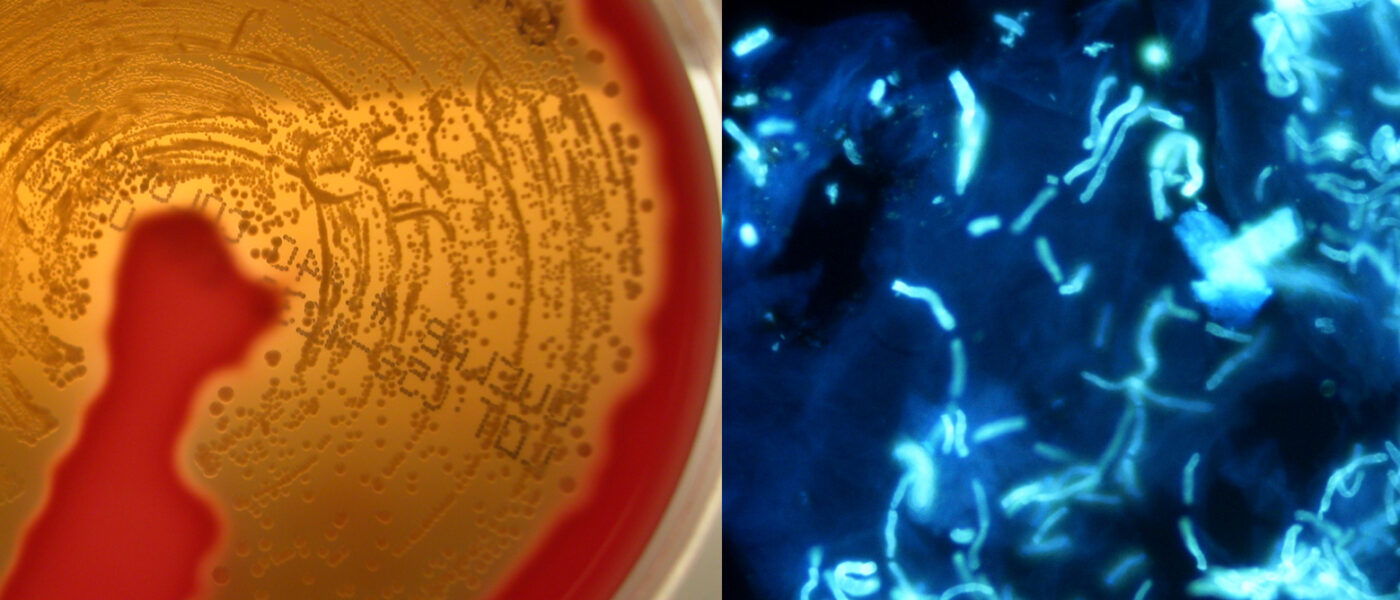 Cell cultures in a plate and under a microscope view